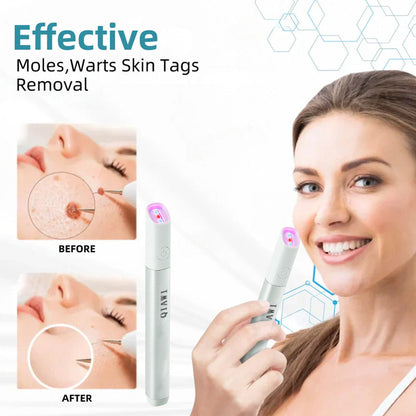 ✨QIAWI™ All-in-One CO₂ Laser Eraser Pen | Removes Moles, Warts, Skin Flaws & Pigmentation