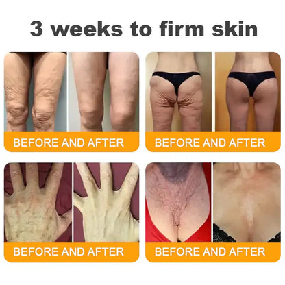 𝐋𝐎𝐕𝐈𝐋𝐃𝐒™ 𝐁𝐞𝐞 𝐕𝐞𝐧𝐨𝐦 𝐀𝐥𝐥-𝐢𝐧-𝐎𝐧𝐞 𝐂𝐫𝐞𝐚𝐦–🌸 Anti-aging,Hydrating, Skin Repair, Even Tone, Acne and Dark Spot Treatment, Wart and Mole Removal, Psoriasis Relief