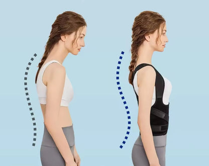 👨‍⚕️ Adjustable Back and Shoulder Posture Corrector (Unisex)